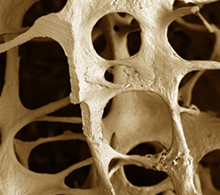 CEDOES promove curso teórico prático sobre osteoporose
